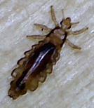What Do Lice Look Like? - Photos Of Head Lice & Nits